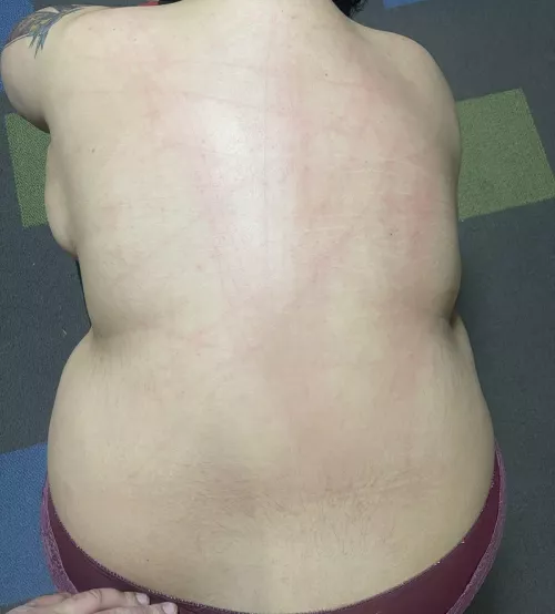 Back marks :) by IllustriousIdeal820