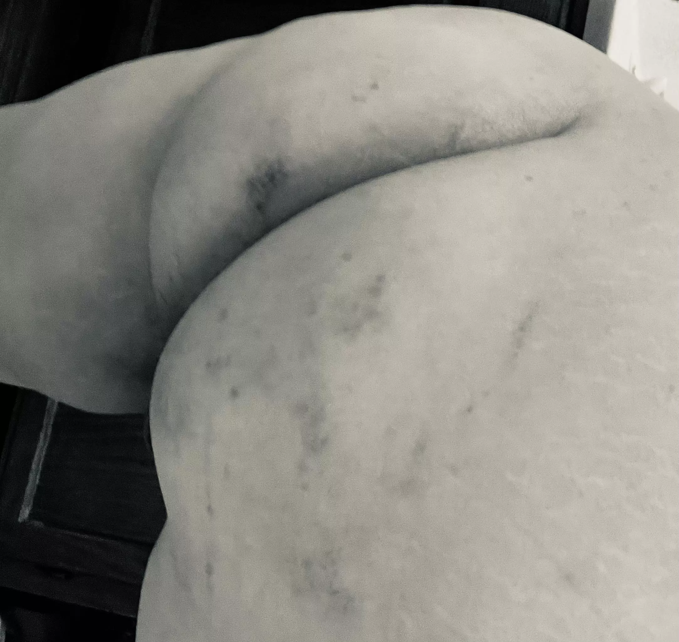 Missing my bruises posted by DuskToDoll