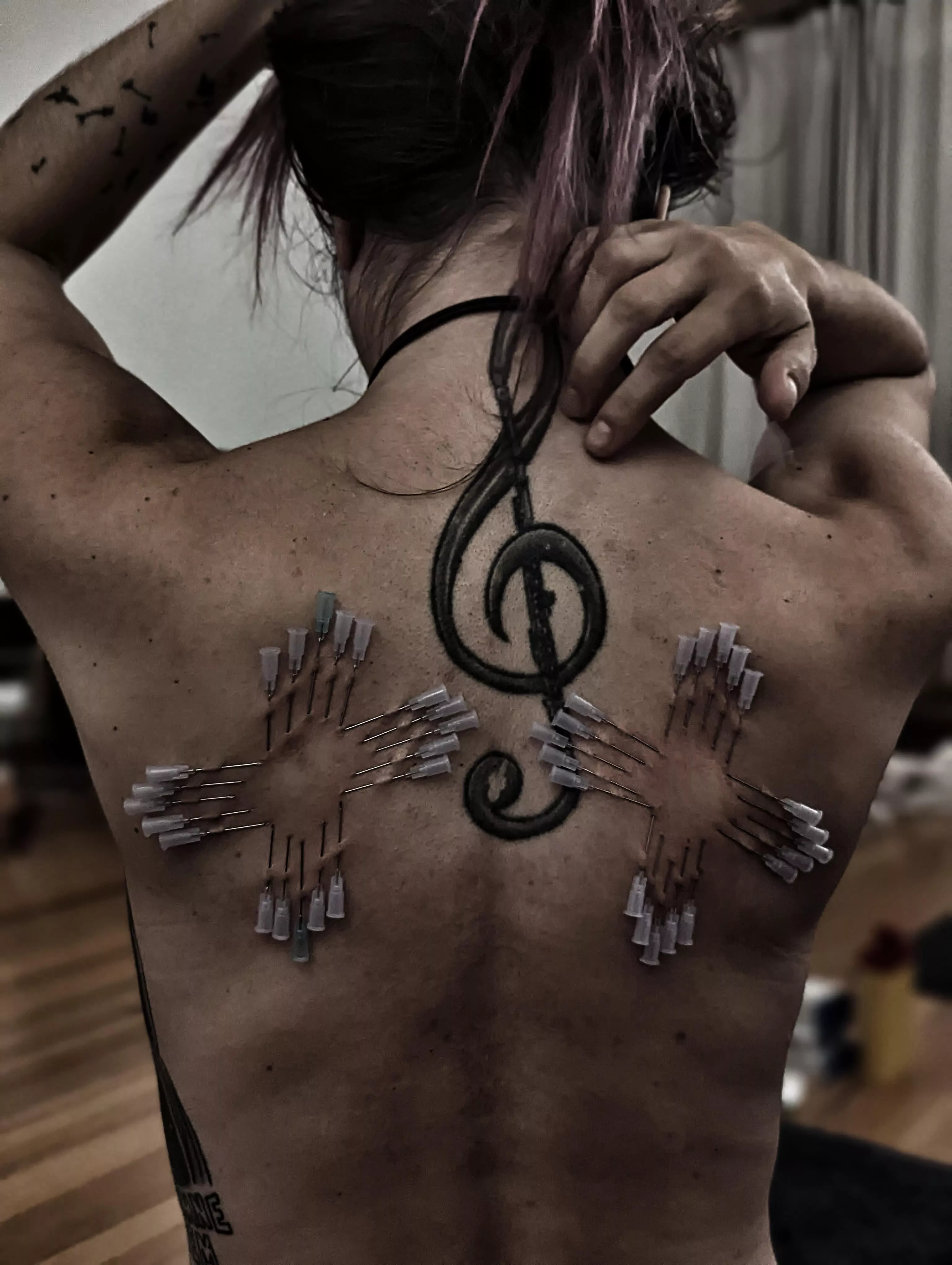 needles in movement posted by semenawa