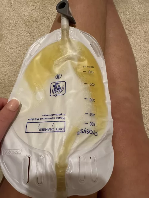 21 F with a catheter  by Piss_Girly