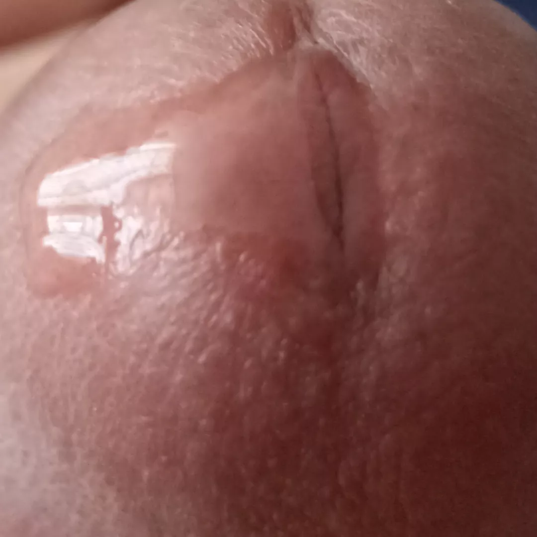 Close precum posted by Standard-Adeptness52