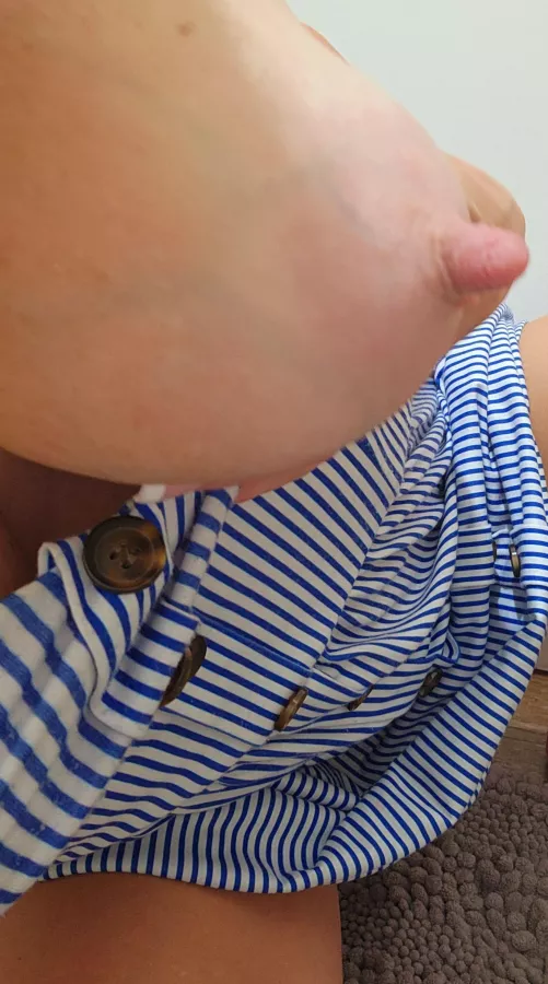 My beautiful veins go with my dress today by PippasMommyDiary