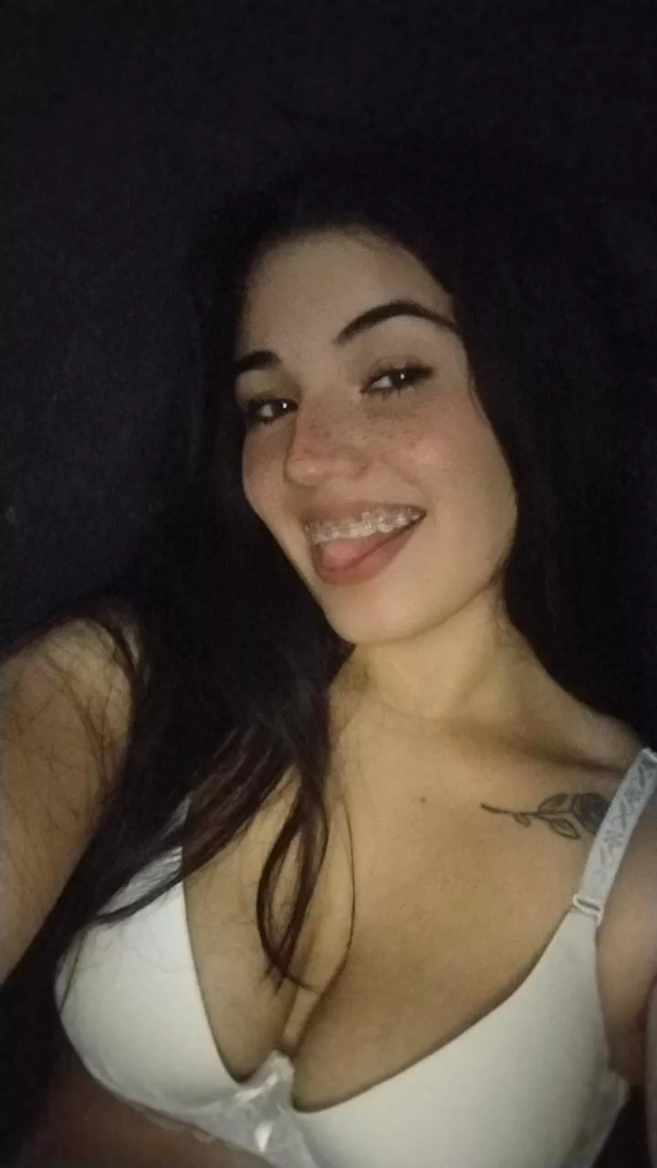 Selfie in mi braces 😋 posted by barbyantonela