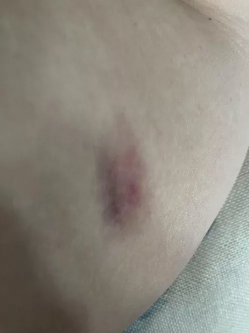 Your sign to wait til it’s ready and make an opening… by Nailkita