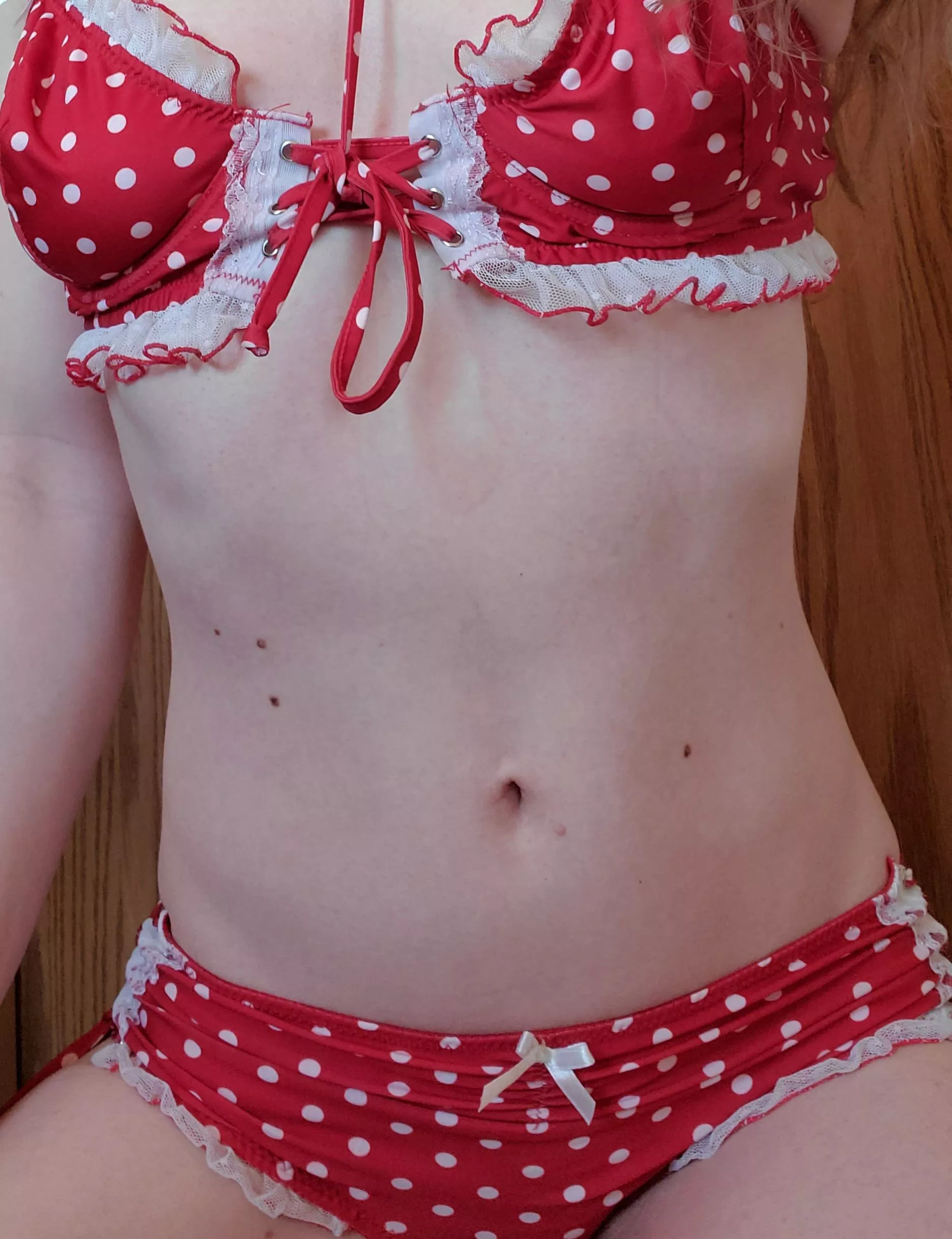 How would you treat such a delicate belly button?  posted by nocapkitten