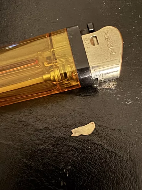 Huge Bone shard 2 years after wisdom tooth extraction by jvctheghost