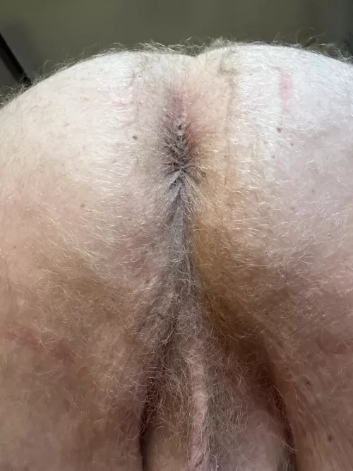 Should I shave it? by Muskable610