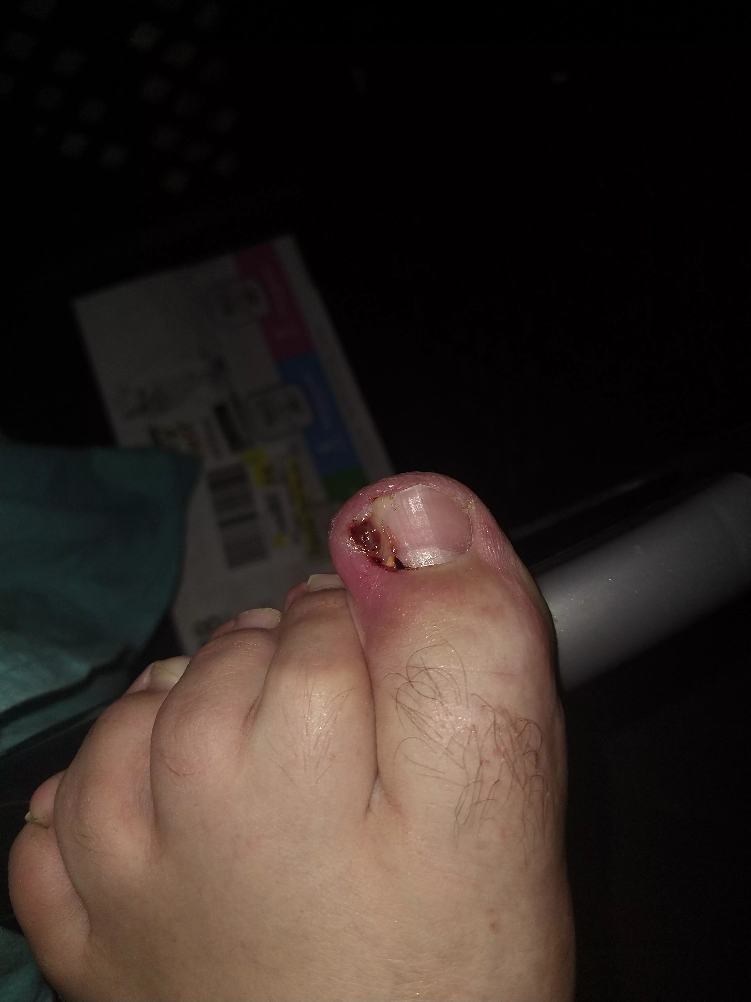 Figured you weirdos, (me included) might want to see this posted by WarBreaker08