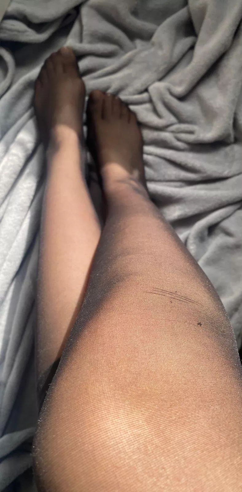 Sunny weather, black nylons, anything else?  posted by obey_my_feet