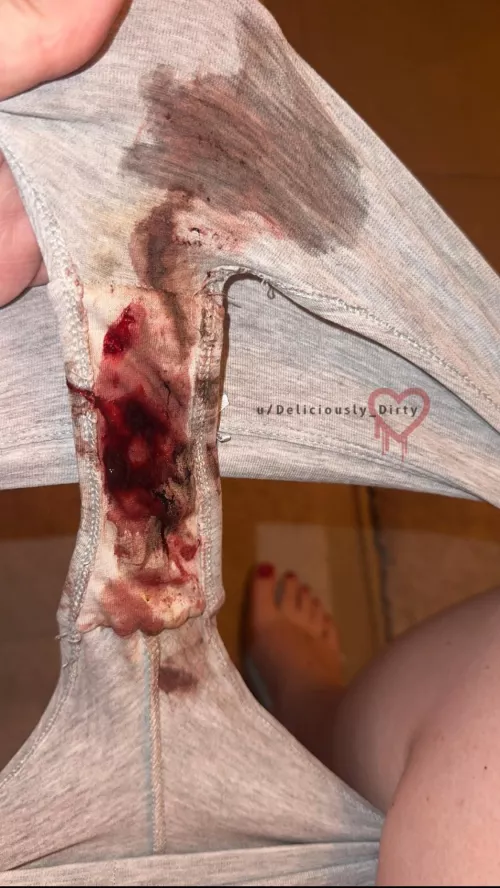 Talk about a bloody surprise! by Deliciously_Dirty