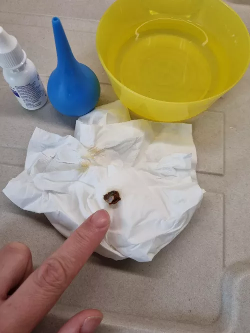 Rinsed out of my ear, everything was suddenly so loud by JadeGreeneDE