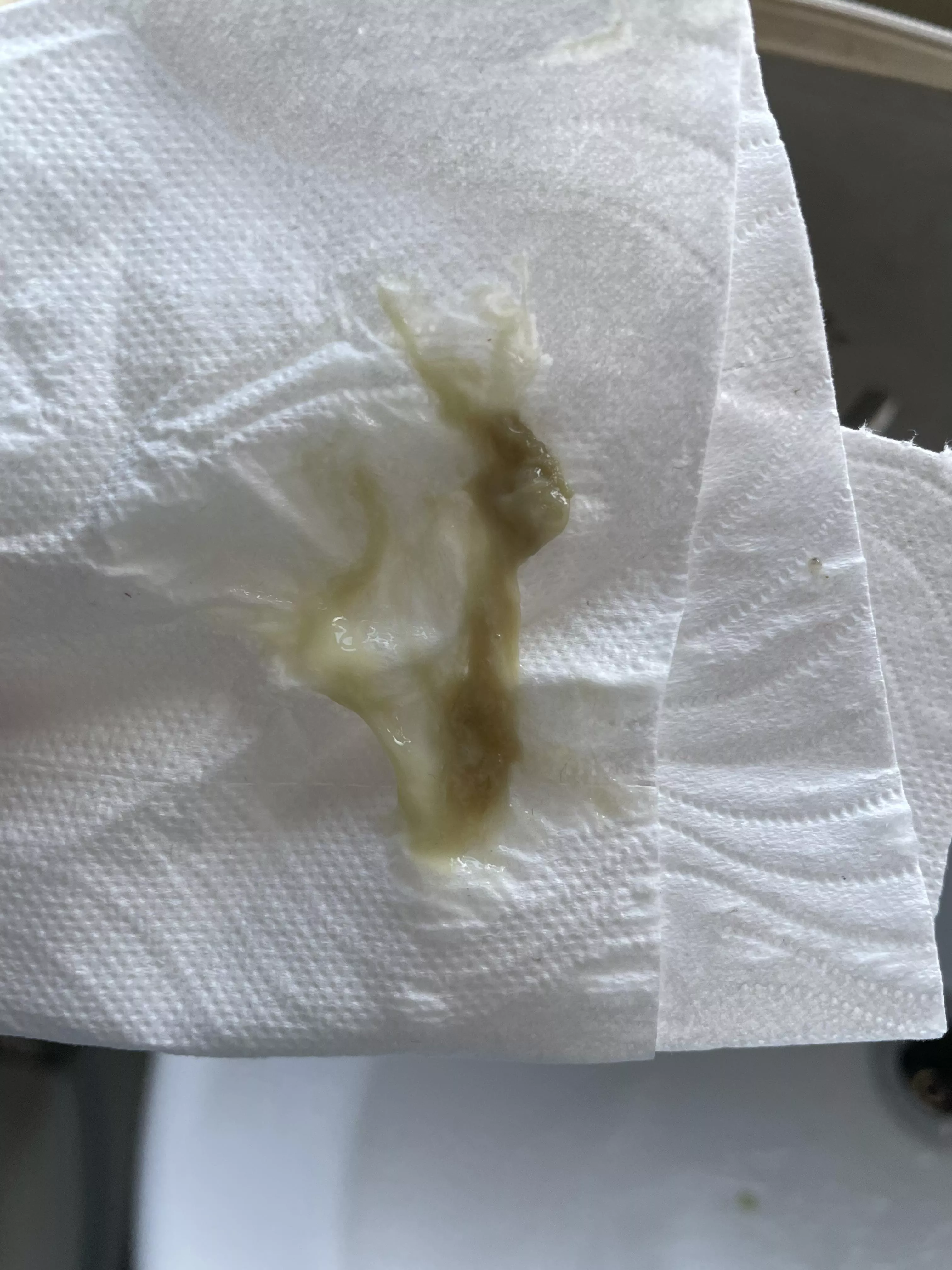 This practically crawled out my nose after a 3 month sinus infection  posted by marsupialface