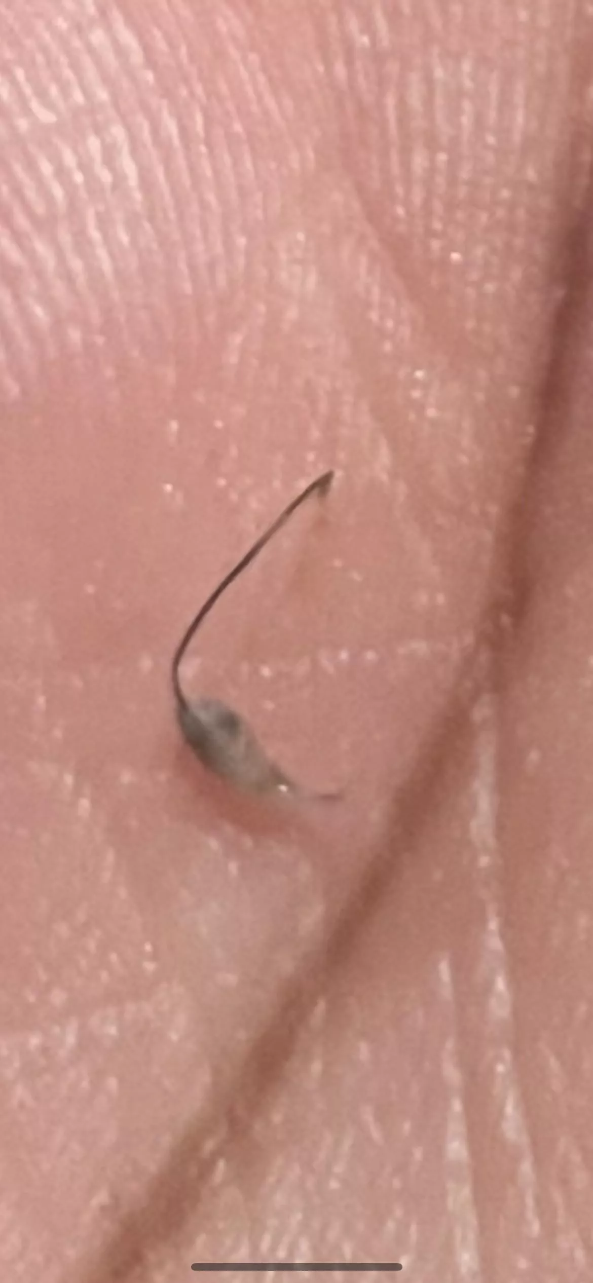 Ingrown/cyst?? Idk.. posted by SuddenDesigner2804