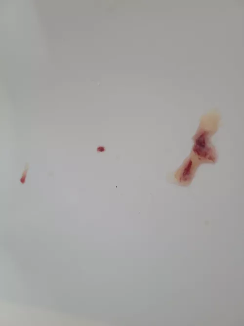 Long time Lurker, first time poster by surgical-panic