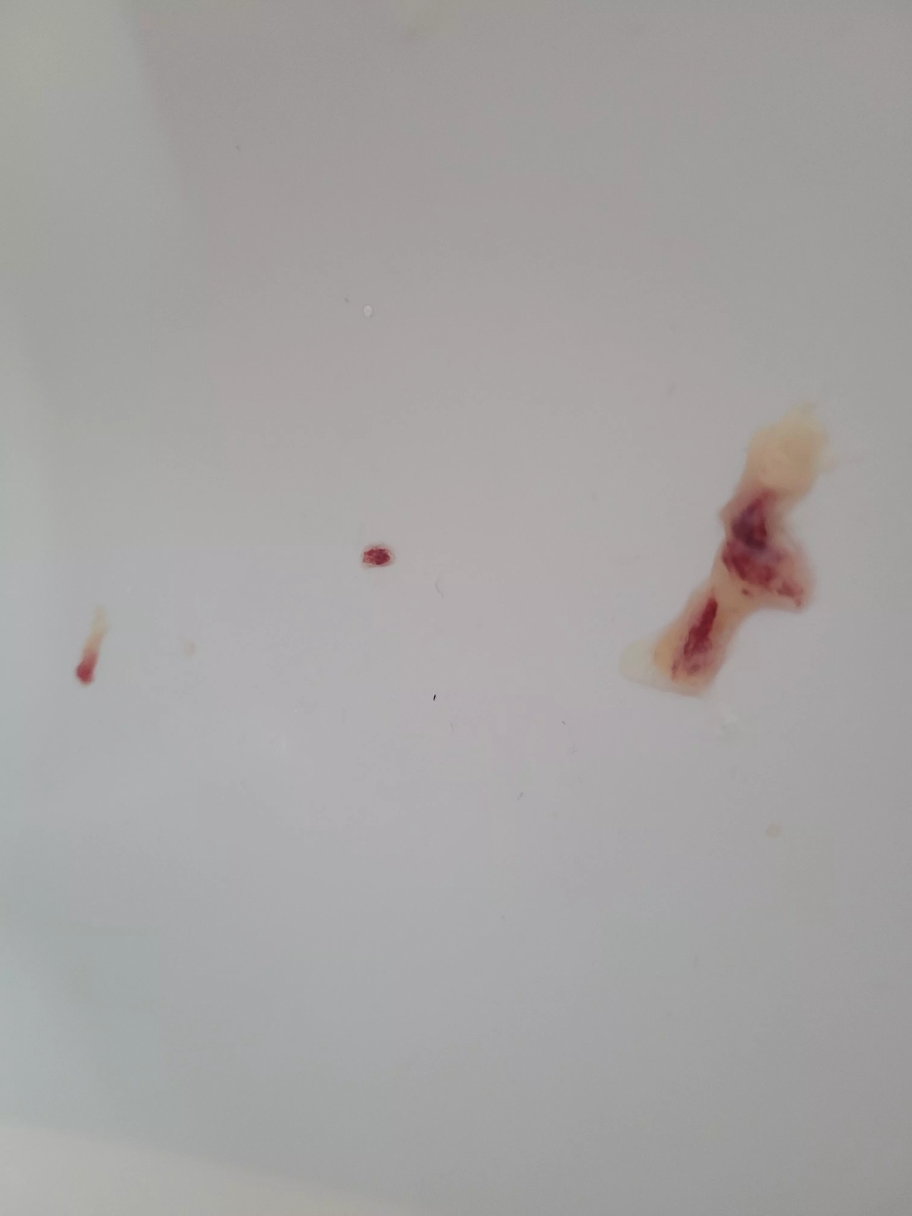 Long time Lurker, first time poster posted by surgical-panic