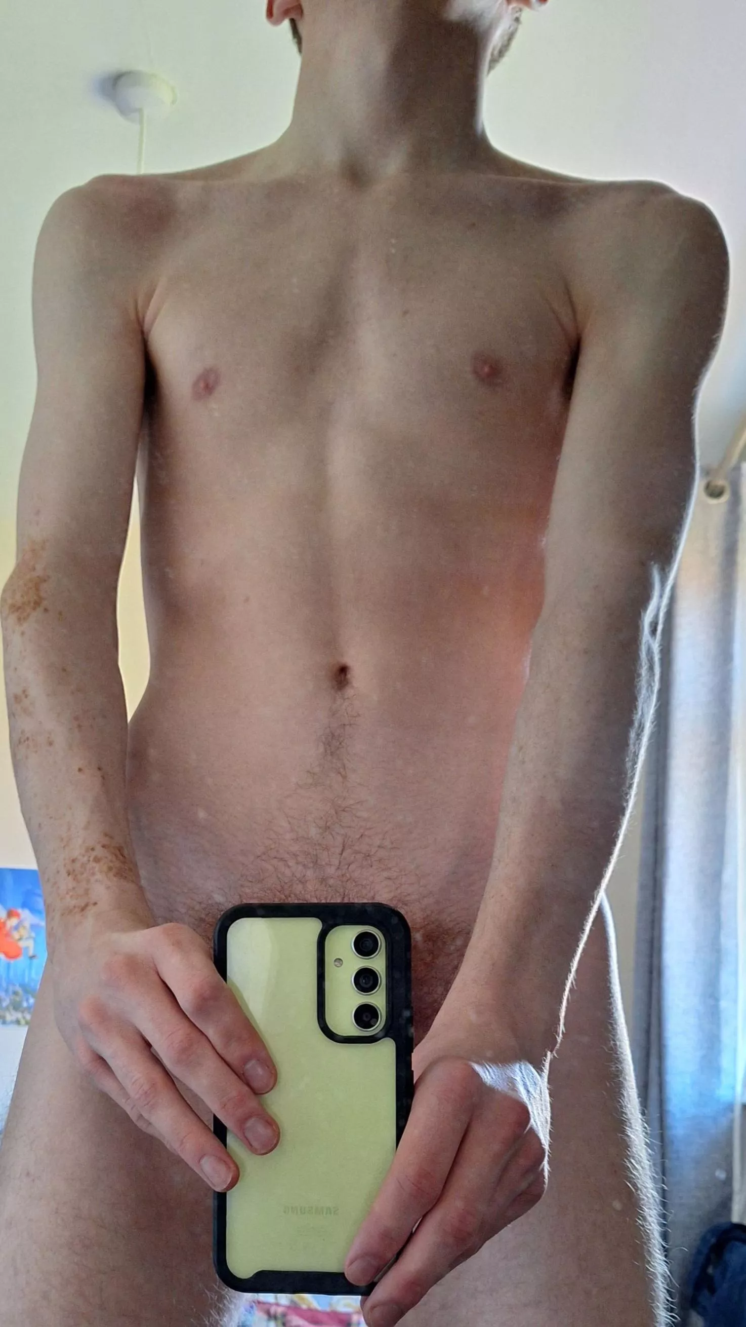 20 (M) I'm quite insecure qbout my face/ back ance, but what about the rest of me? posted by Acceptable_Emu_6990