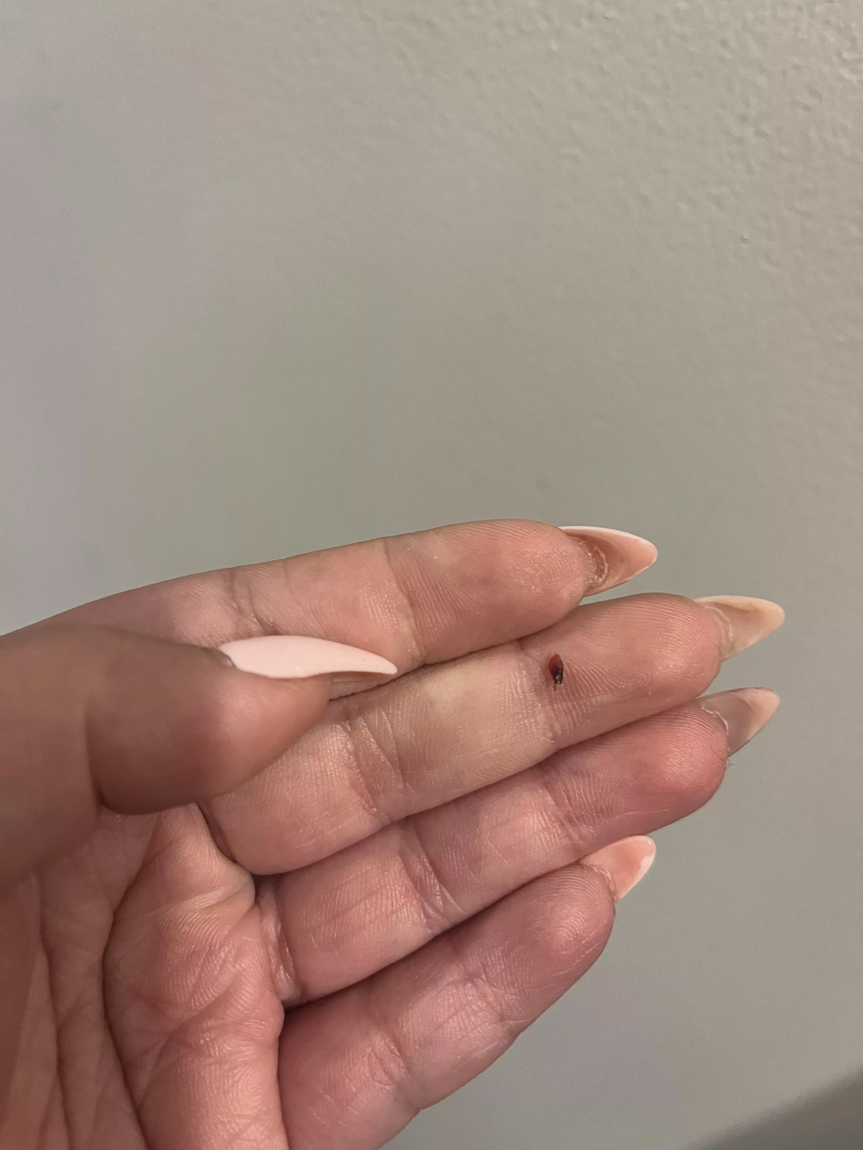 Got his out of my scalp posted by nicksbrunchattiffany