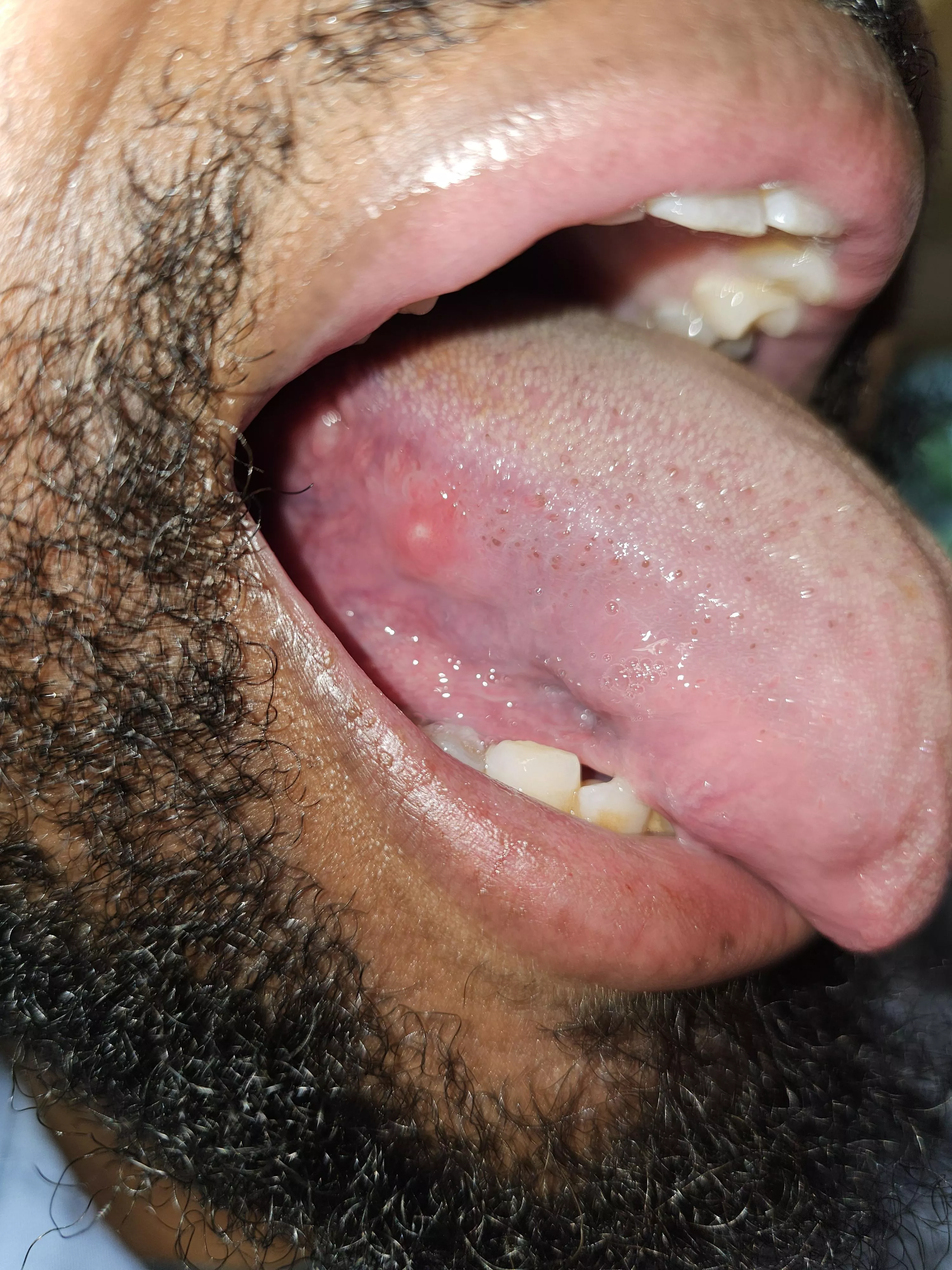 First time this has happened posted by madthunder55