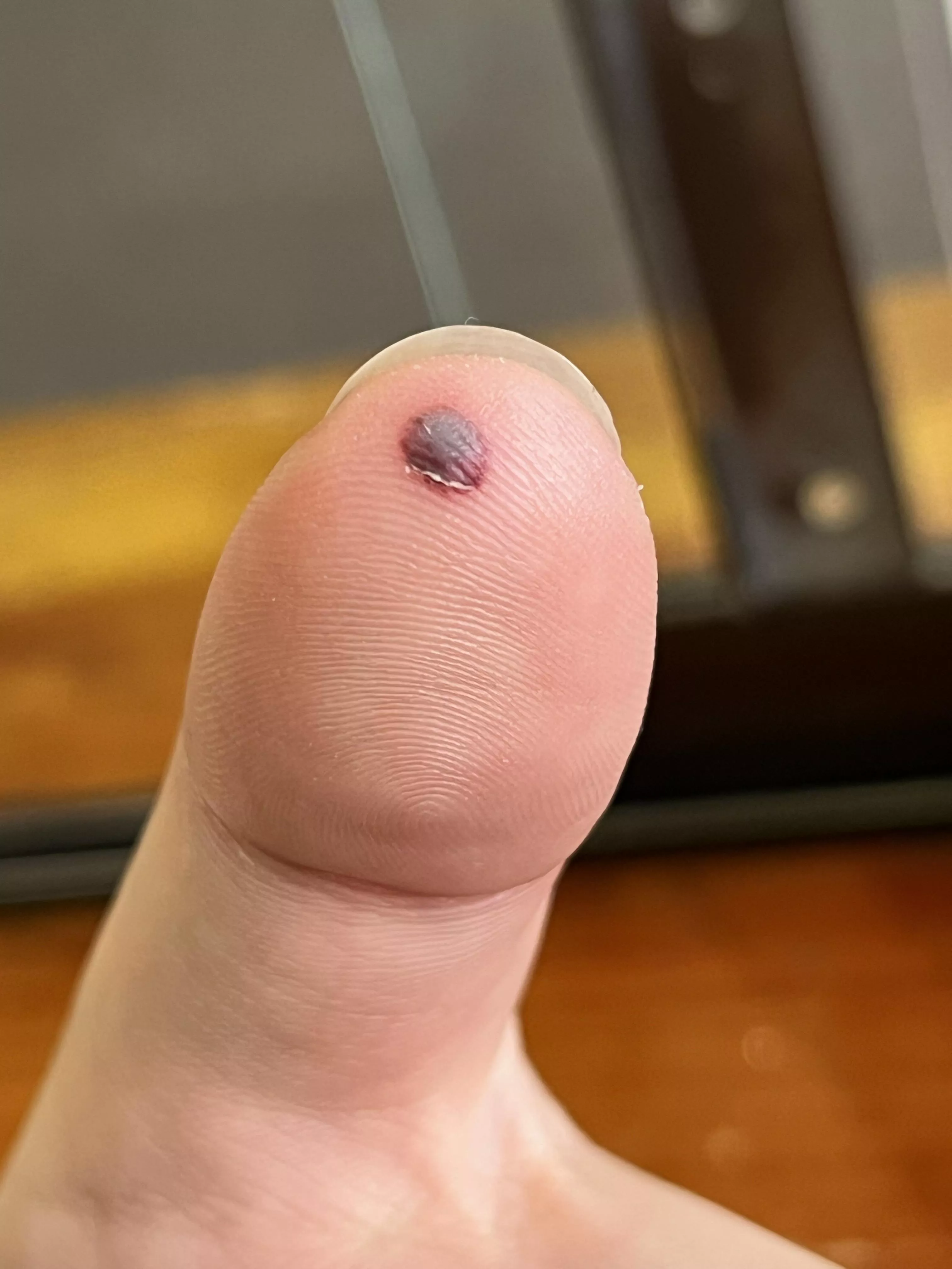 Forbidden! There’s so much pressure I want to pop it. posted by inconspicuous_aussie