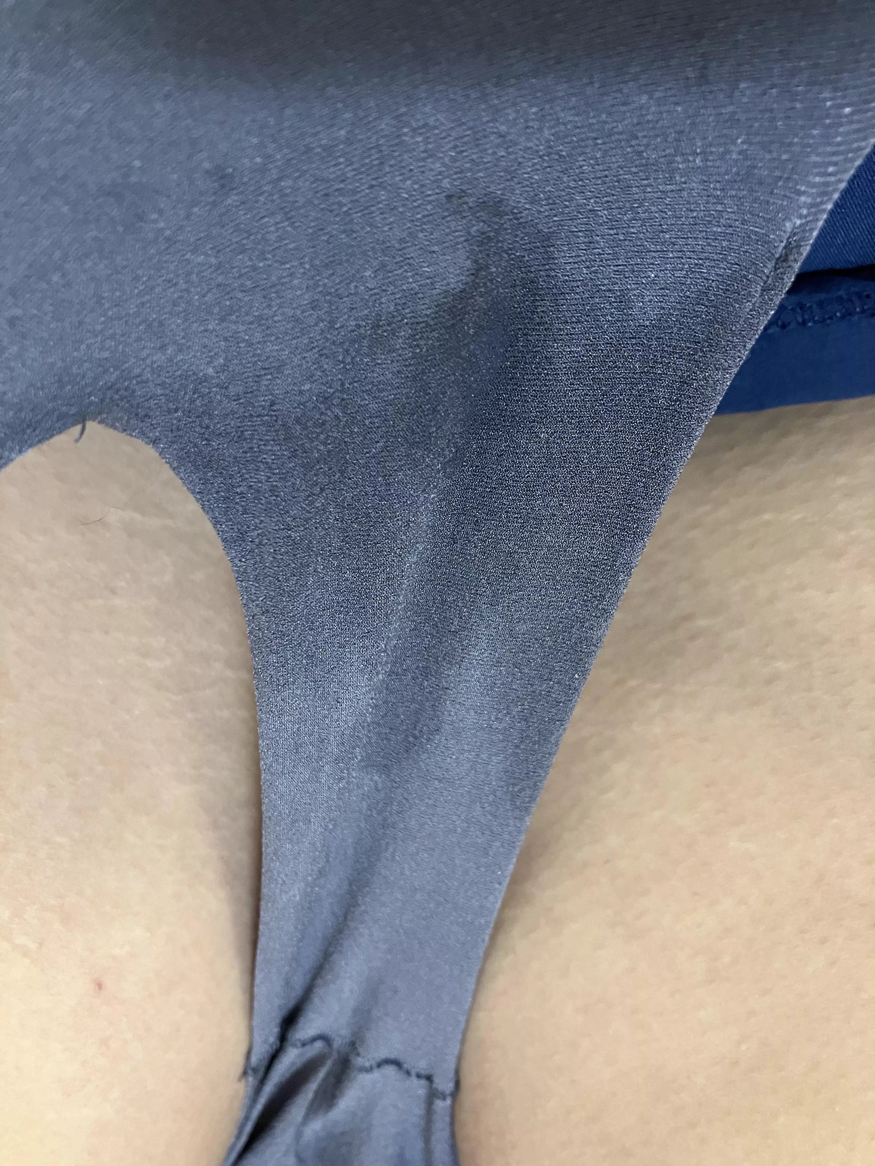 I got too excited again posted by NaivePanda5274