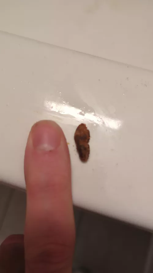 Just had the nastiest impacted earwax of my life by thelsdthrowaway