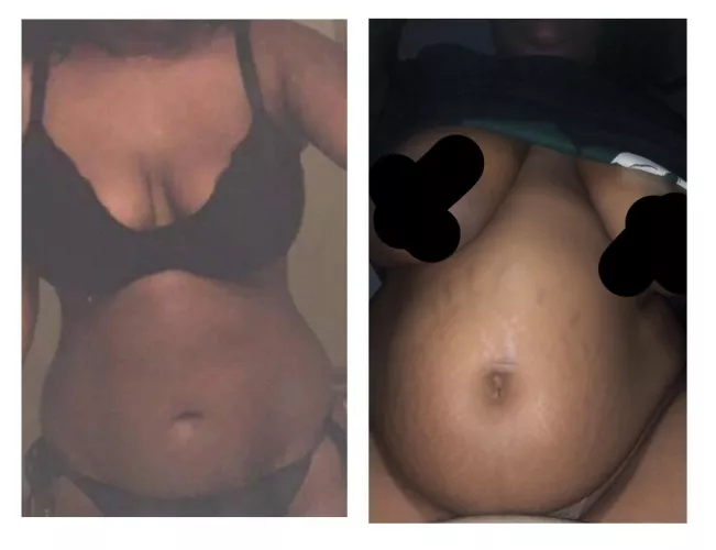 Mesmerized by how wide my belly button got 🙄 Im also now covered in stretchies 😬 by Urfavesnack5699