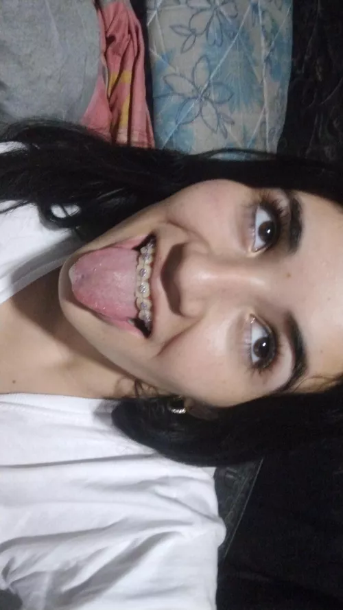 Braces a pervert  by barbyantonela