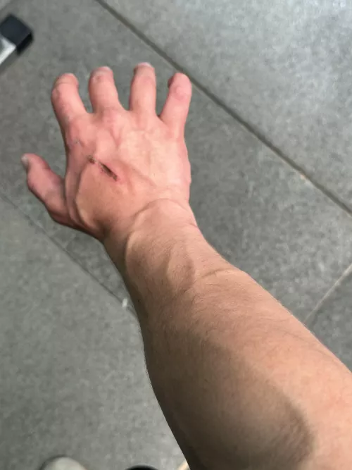 Veiny and injured by realisiwak