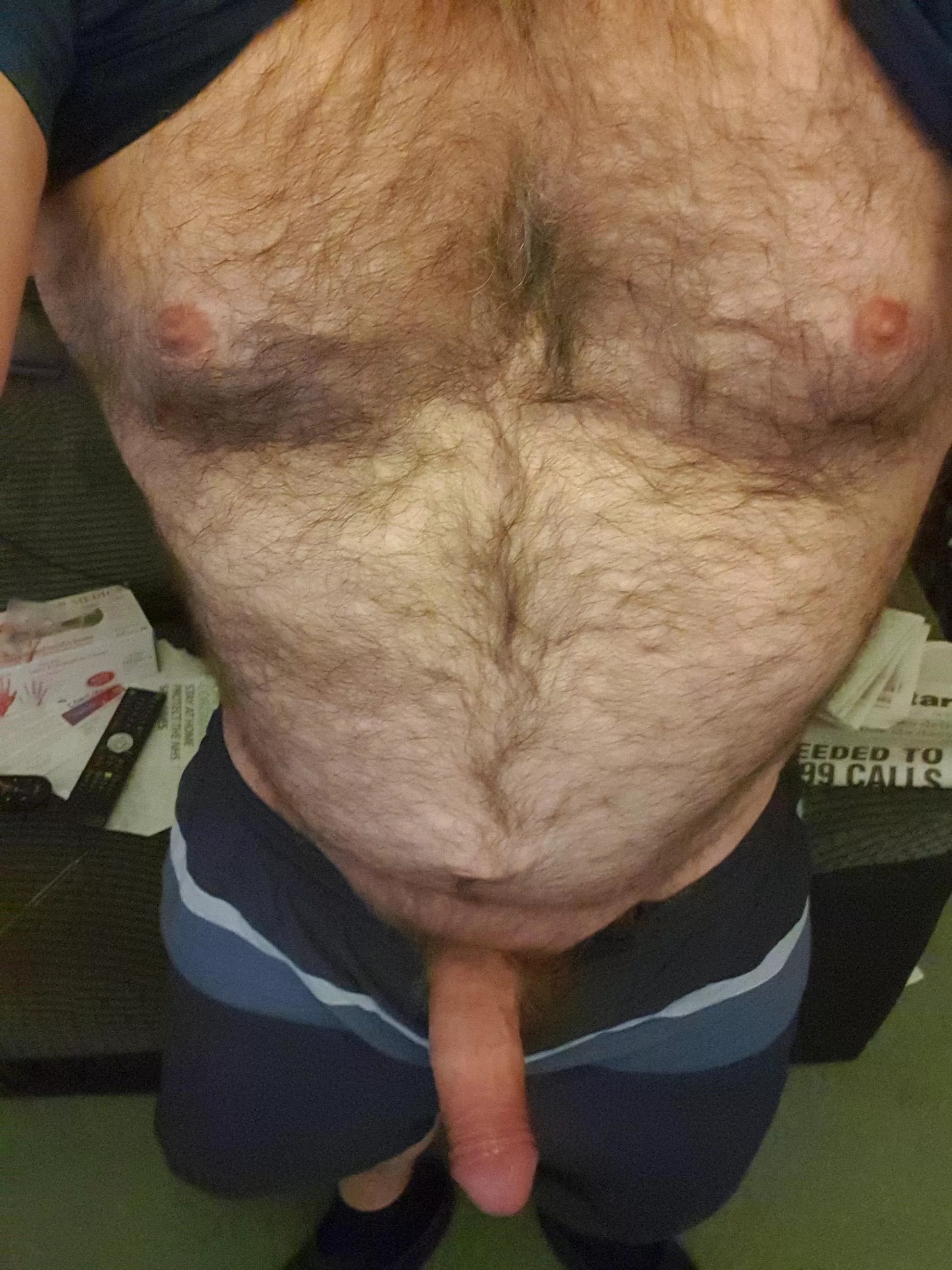 Hairy  posted by Parking-Pride239