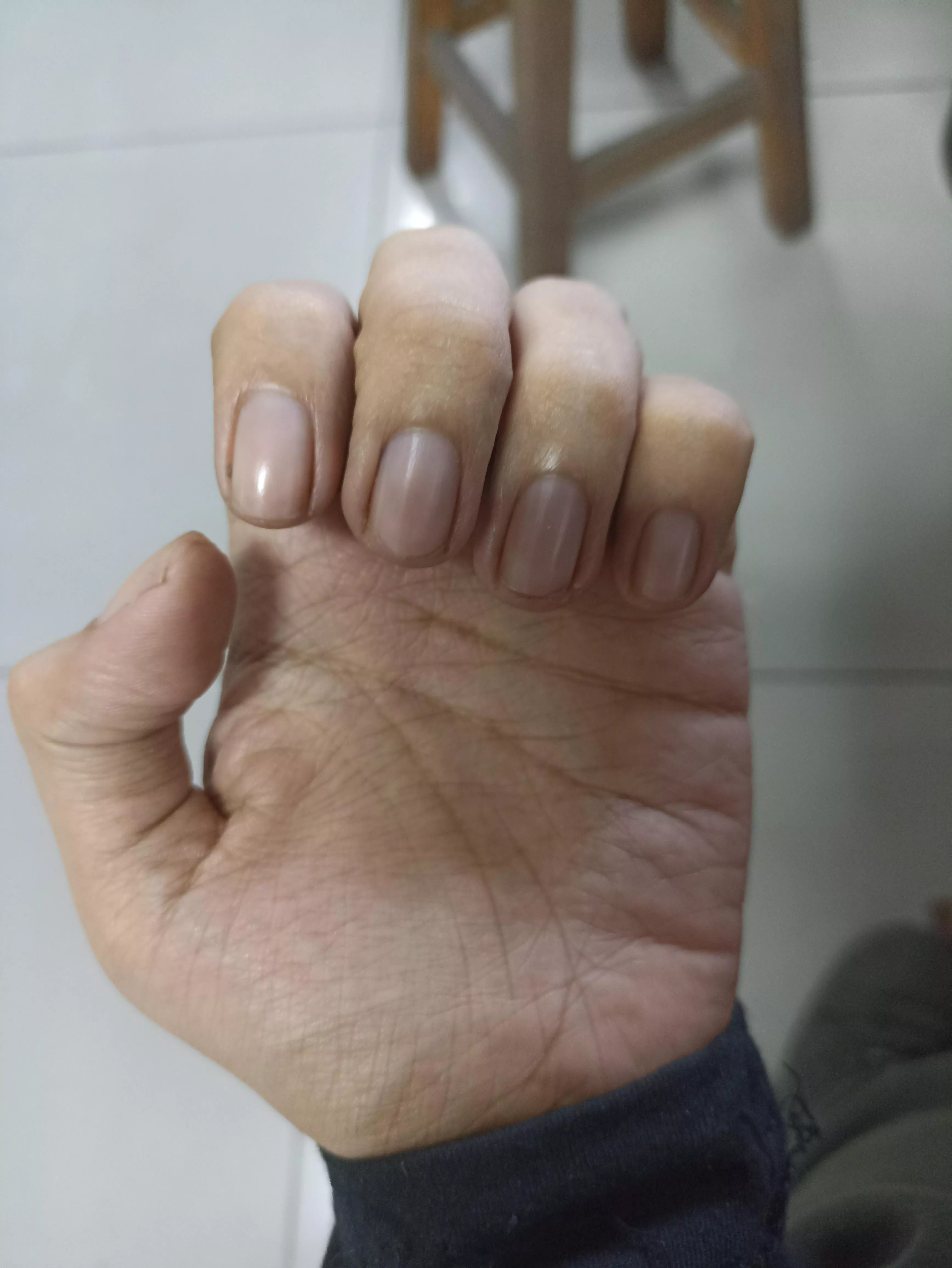 Male (27) that every girl he knows have told him that he has girly nails and hands. posted by Miserable_Cherry_272