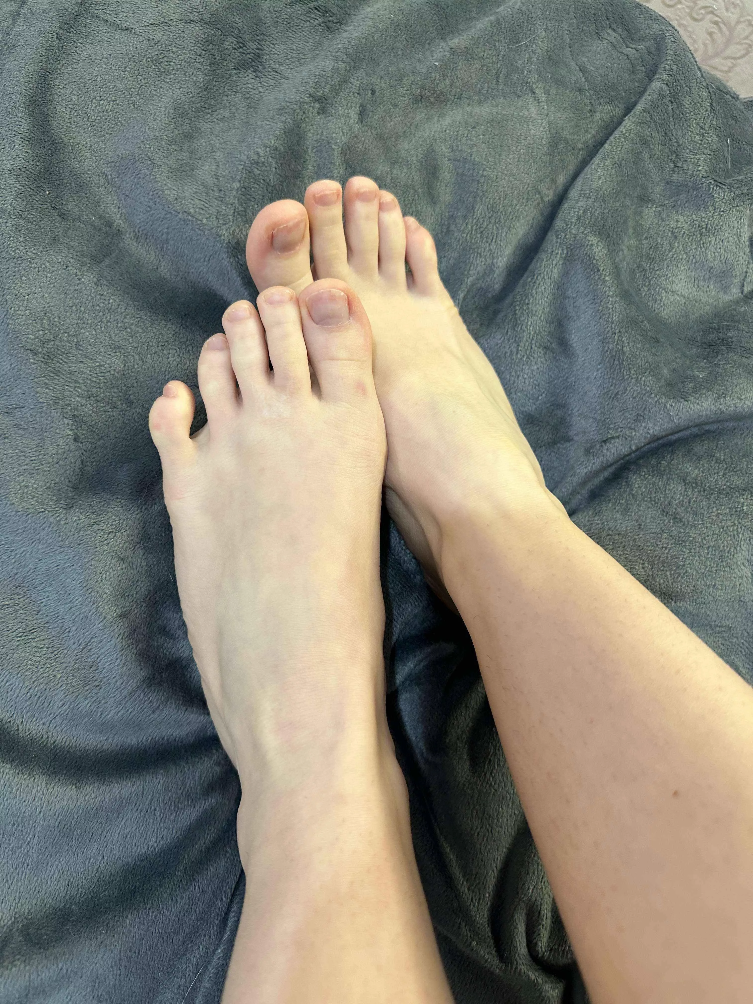 My ex-boyfriend considered my toes not the best posted by LagoonOfDreams
