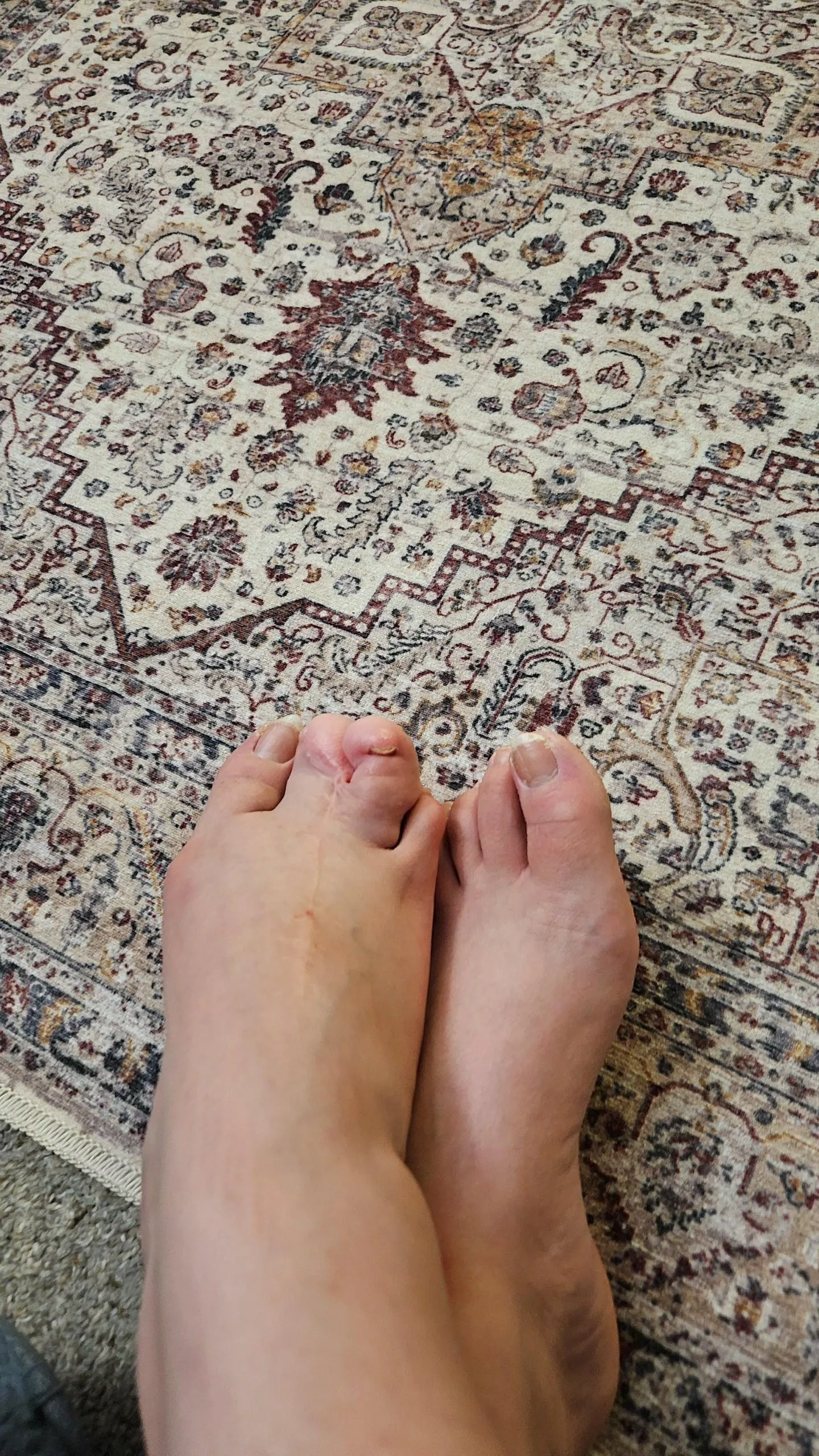 Deformed foot. Could I make money off my foot?  posted by leiigrace