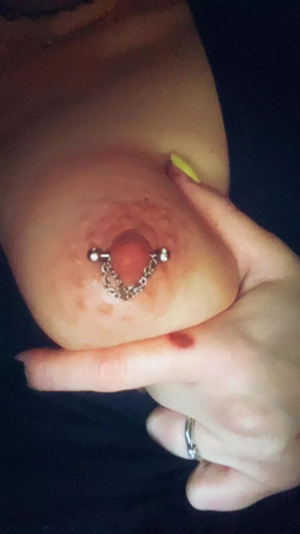 [Mrs,37] Meeting or not, I just had to whip out my new piercing for you guys ☺️ posted by VeroVexy