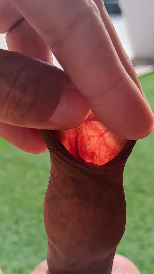 Have you ever seen your foreskin through the sun?  by hakunamatata80