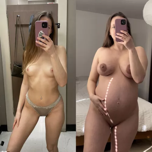 Before vs now [37 weeks] by VioletVanDyke