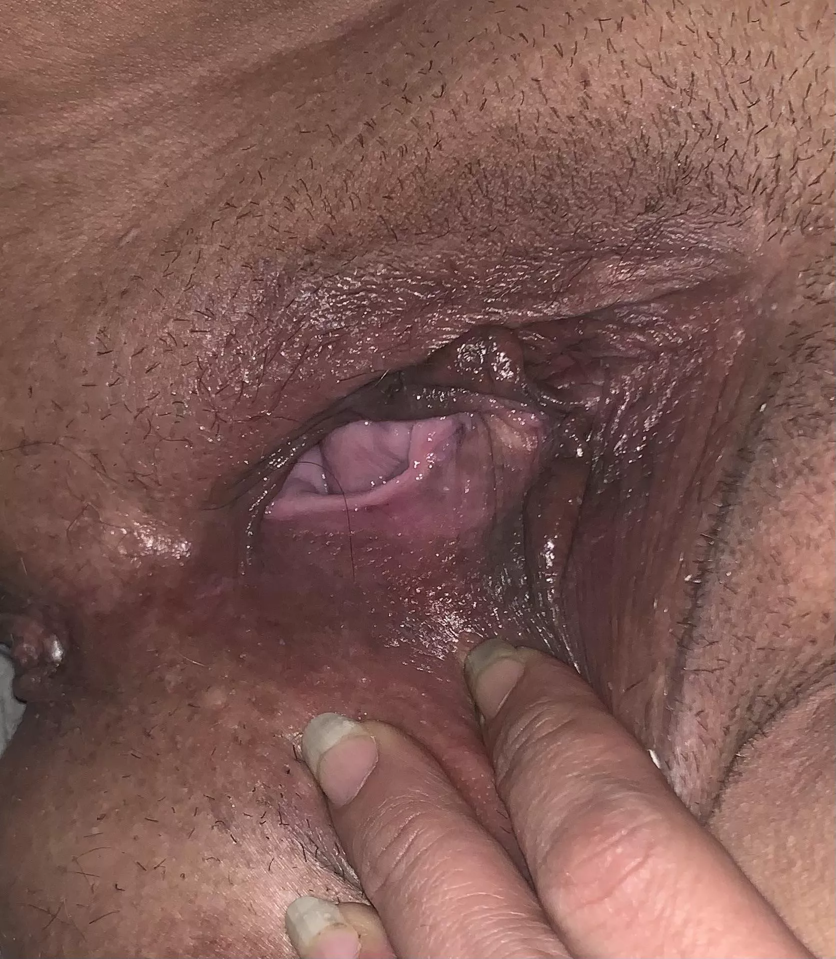 Im making progress with my gape. posted by Ambitious-Passion523