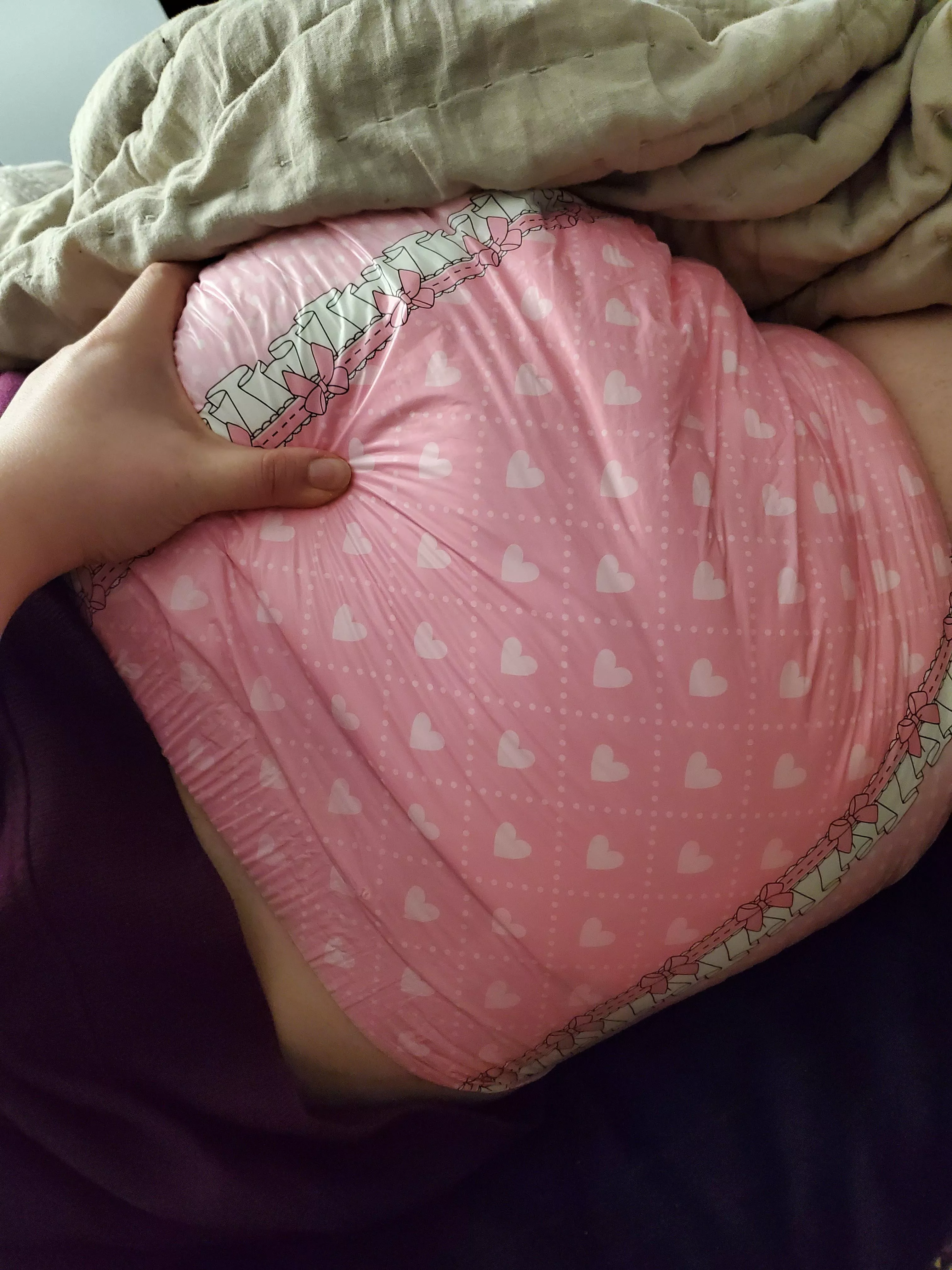 Could you wake up to this soggy butt every morning? posted by wedgieofdoom