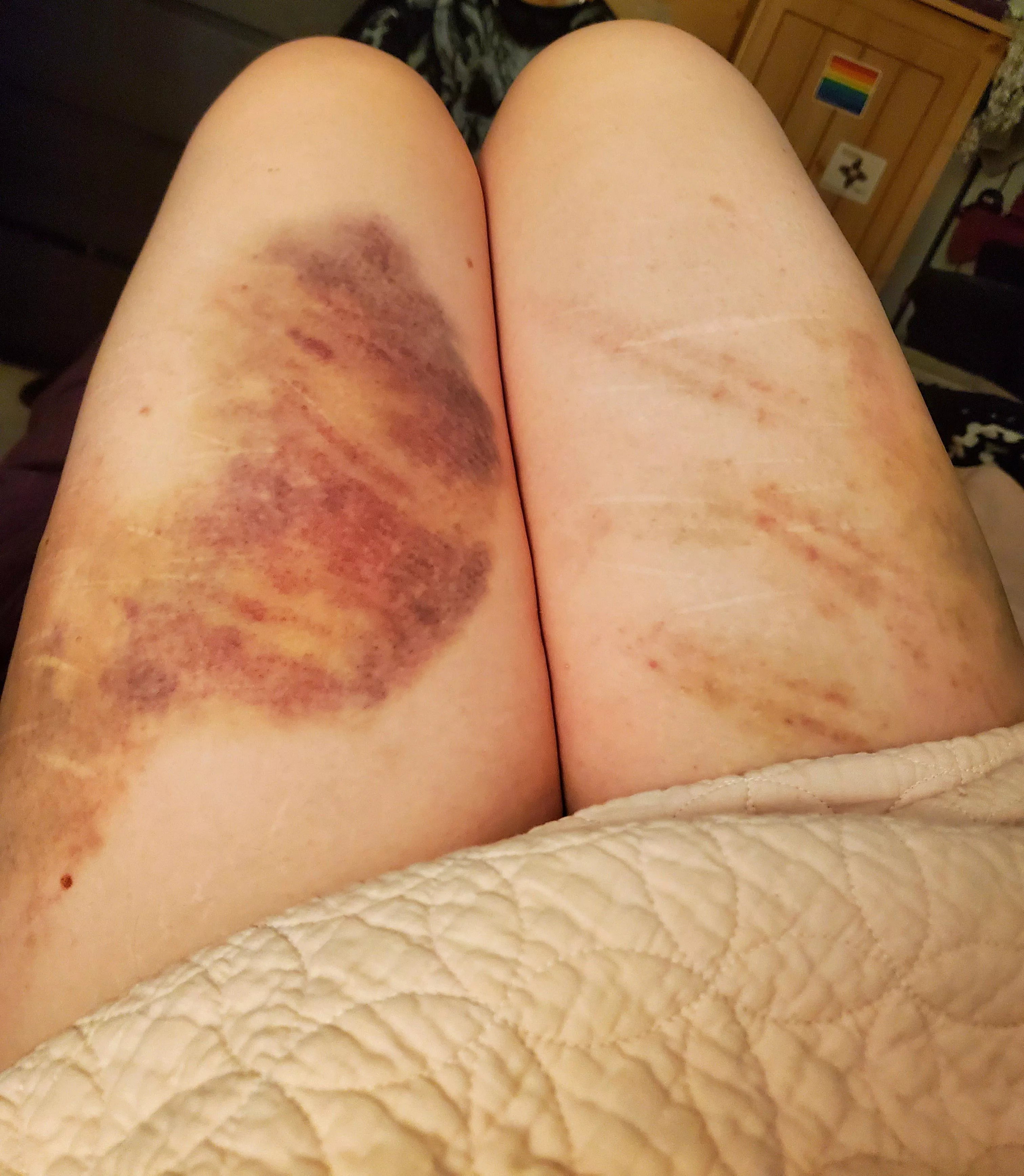 Galaxy Thighs posted by purezoetry