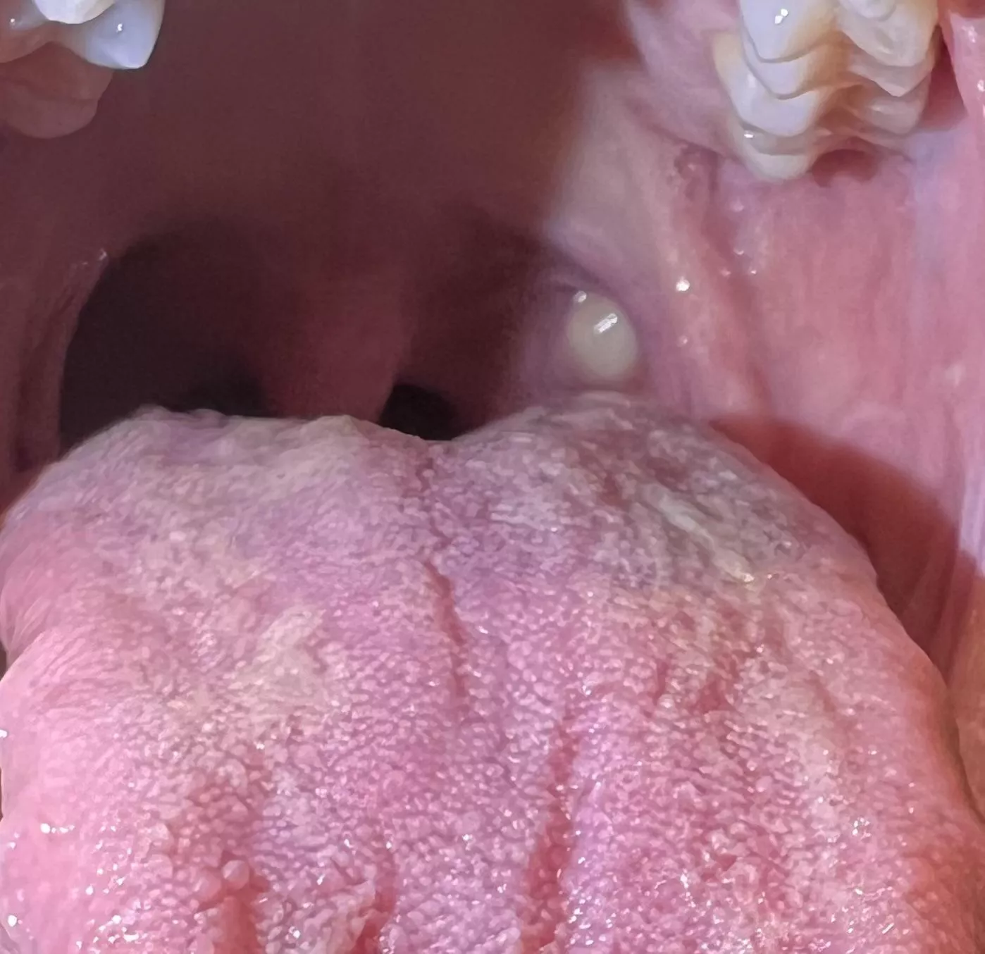 What is this in the back of my throat? posted by KintsugiWanderer