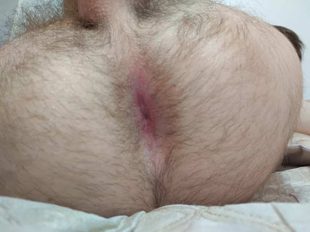 What would you do to that hole? posted by Previous_Ticket3361