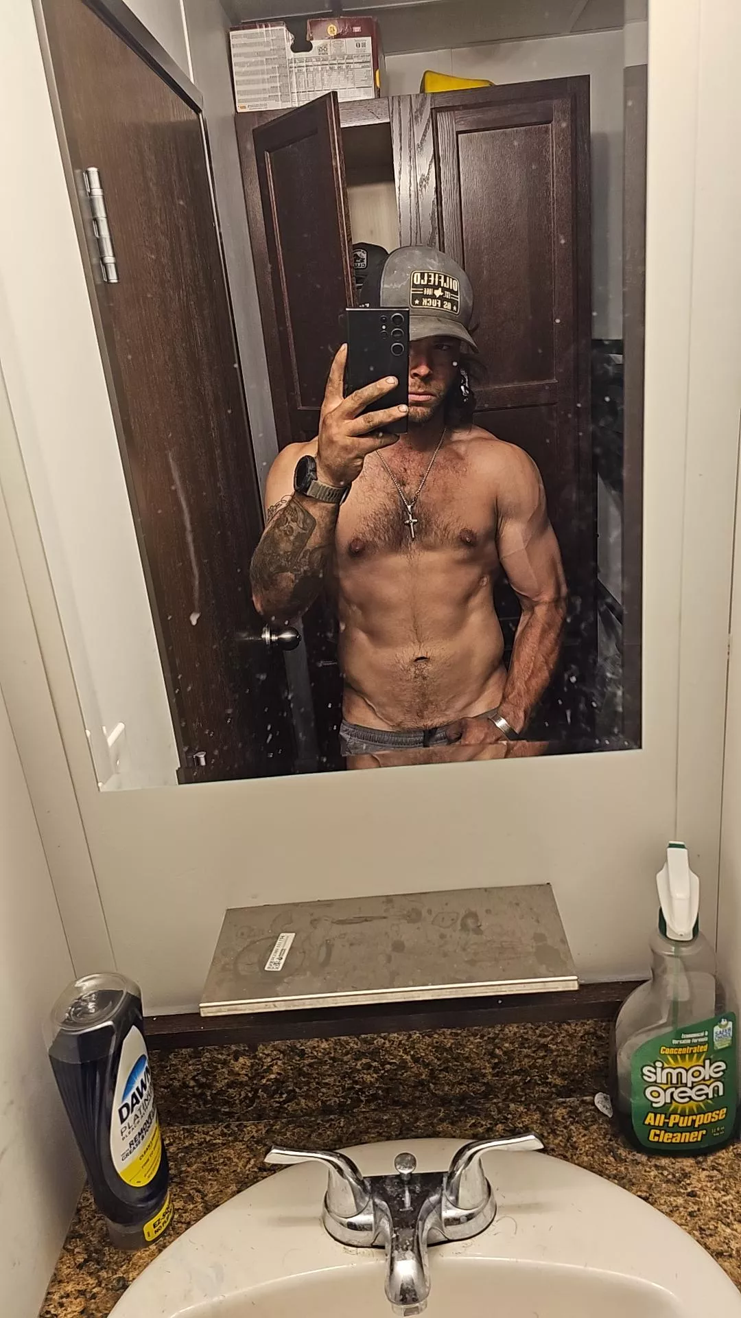 Are my arm veins good enough for here? posted by Kooky-Ring1535