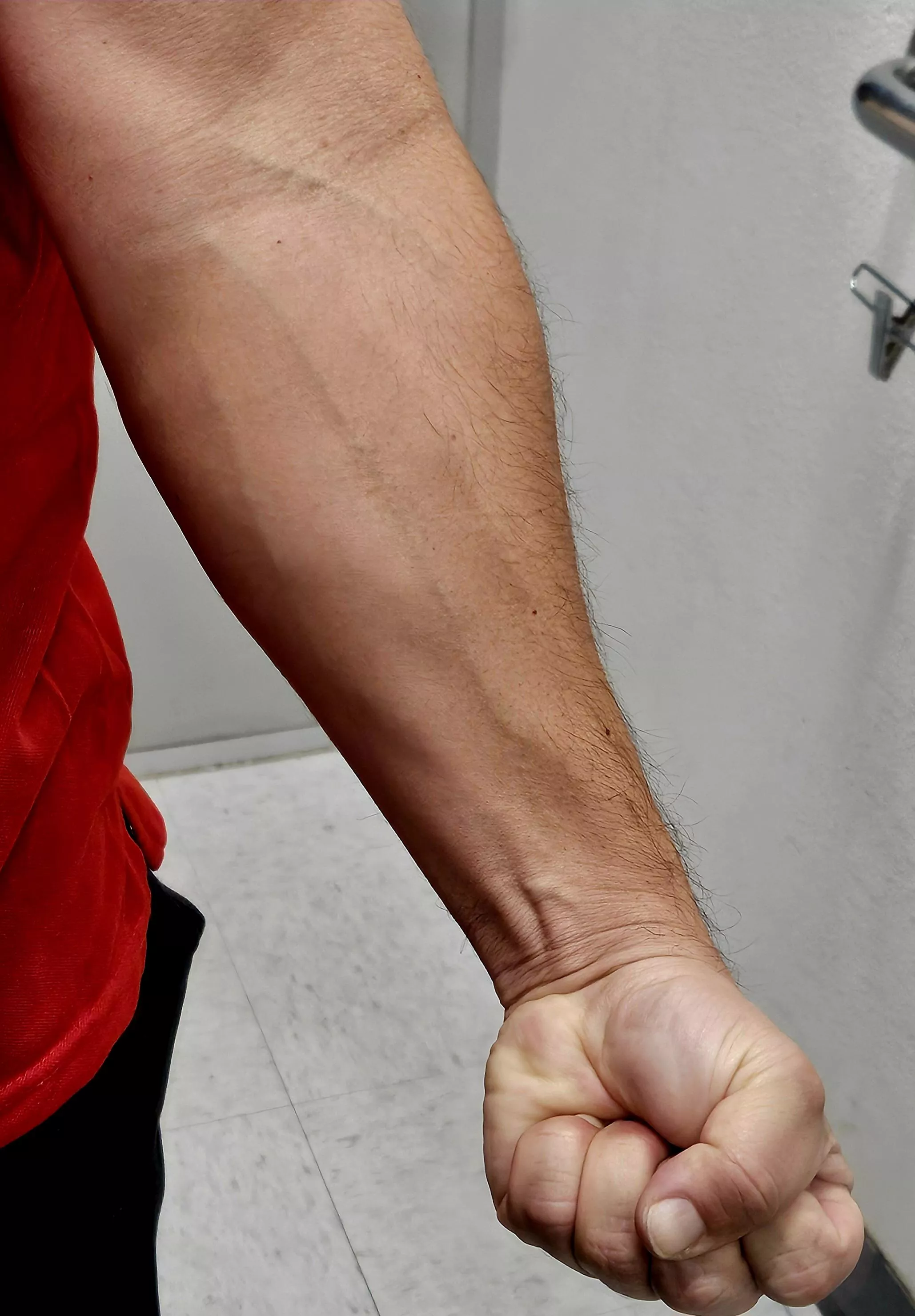 Getting veinier every month... posted by bobbiebulge56