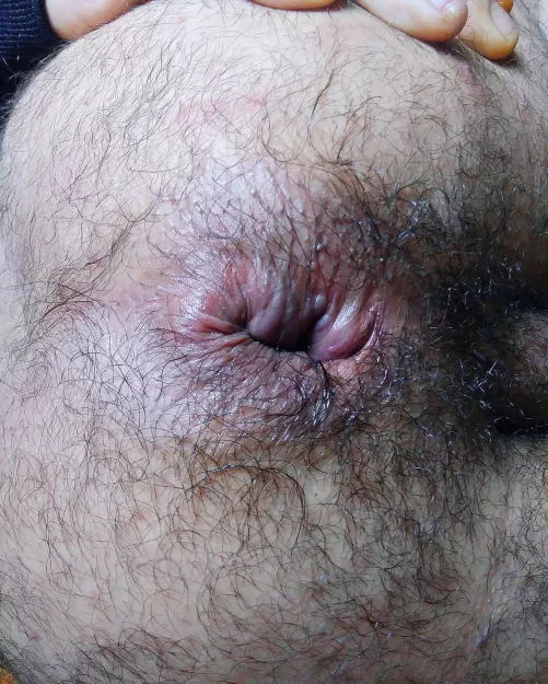 My hairy asshole stretched by Jonnahtan40