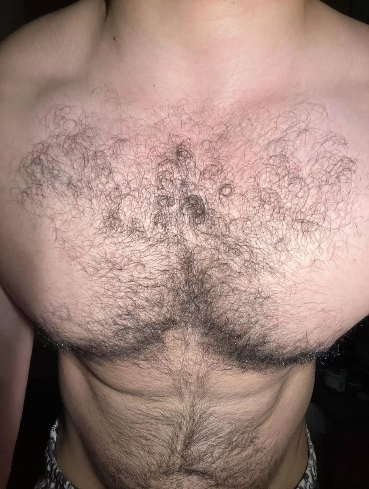 After a good chest pump posted by Ok_Pay1943