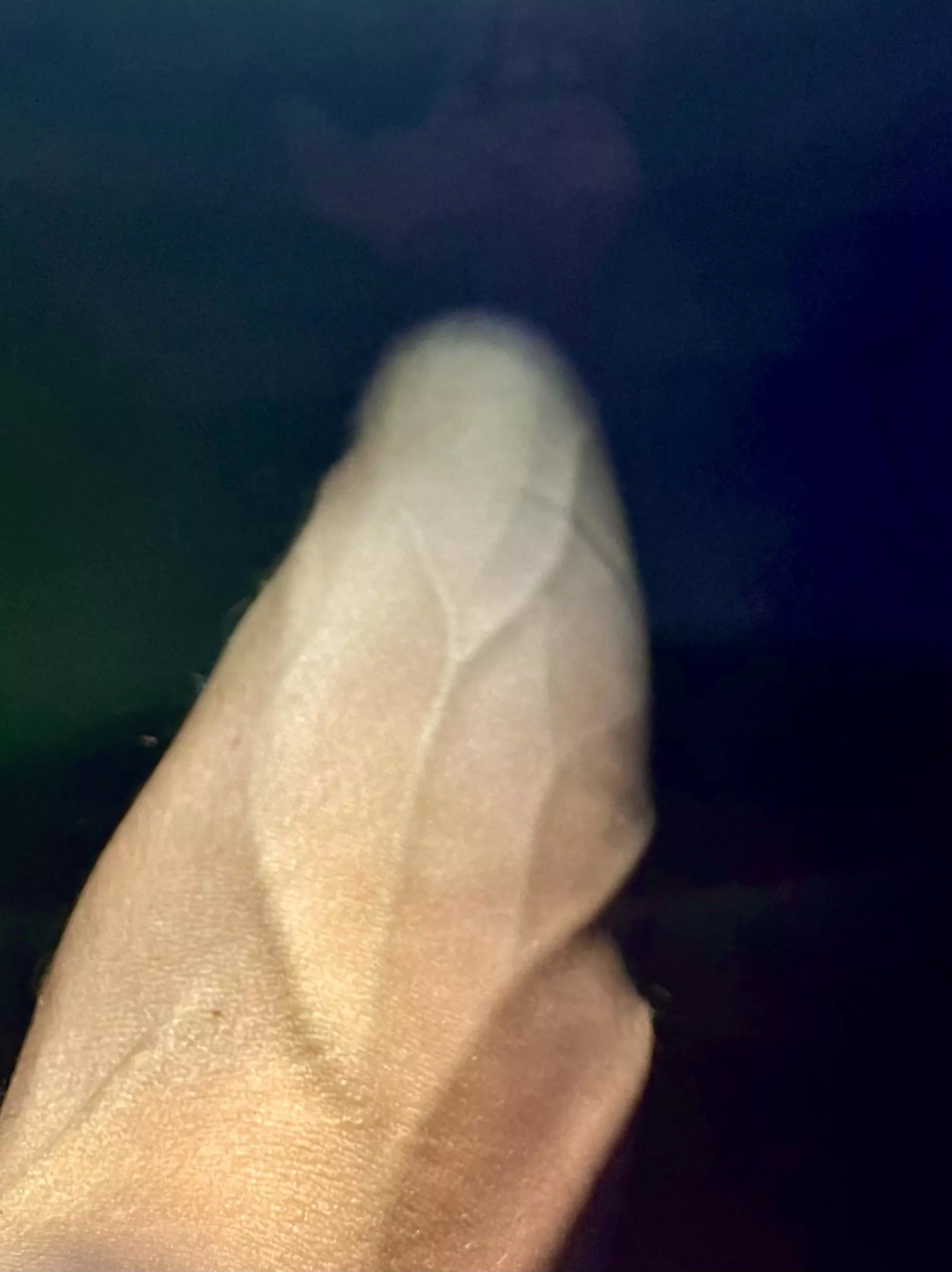 Hope you don’t mind a lil burn scar, bacon pan zapped me 🥓 posted by Johnnyice_