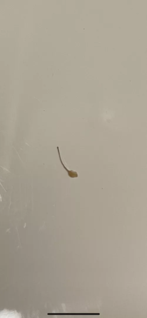 Ingrown hair after wax  by EmotionalAd3820