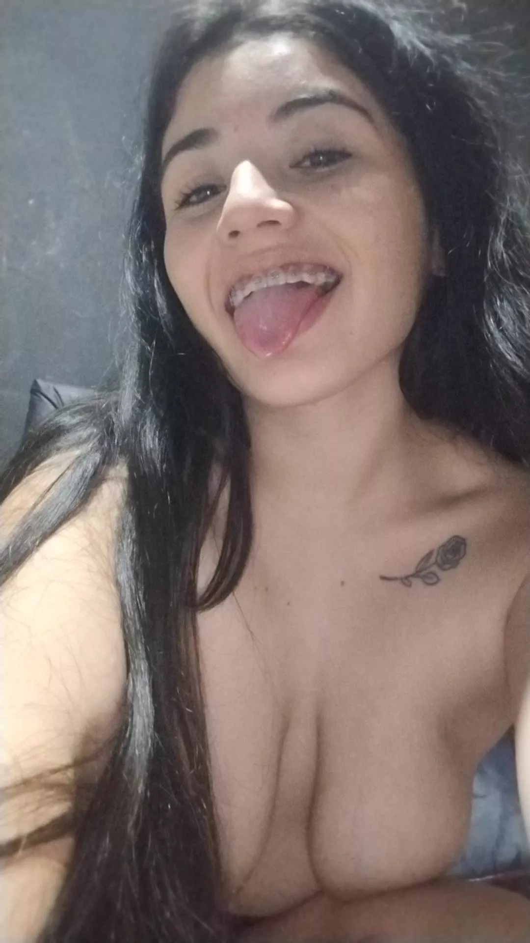 Which will be richer, my braces or my nipples? posted by barbyantonela