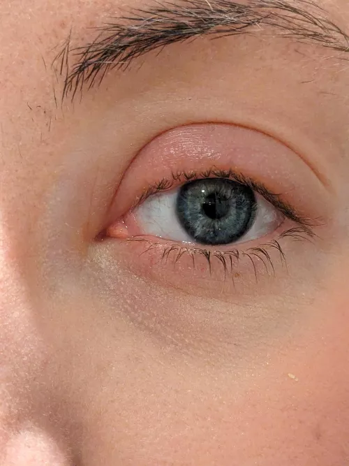 Who else loves styes? :D by kyoopta