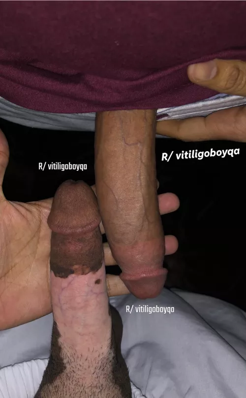 🇶🇦 X 🇳🇬 by vitiligoboyqa