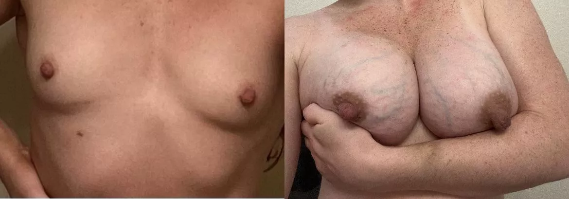 Do you prefer my flat chest of engorged milky tits? posted by BespokeWhore